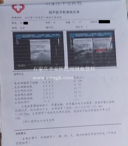 糖尿病肢体动脉闭塞症中西医结合疗效好